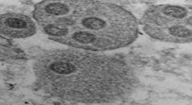 신종 코로나바이러스 균